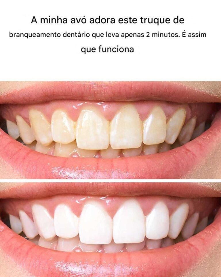 A minha avó jura que este truque de branqueamento dentário demora apenas 2 minutos. Como funciona